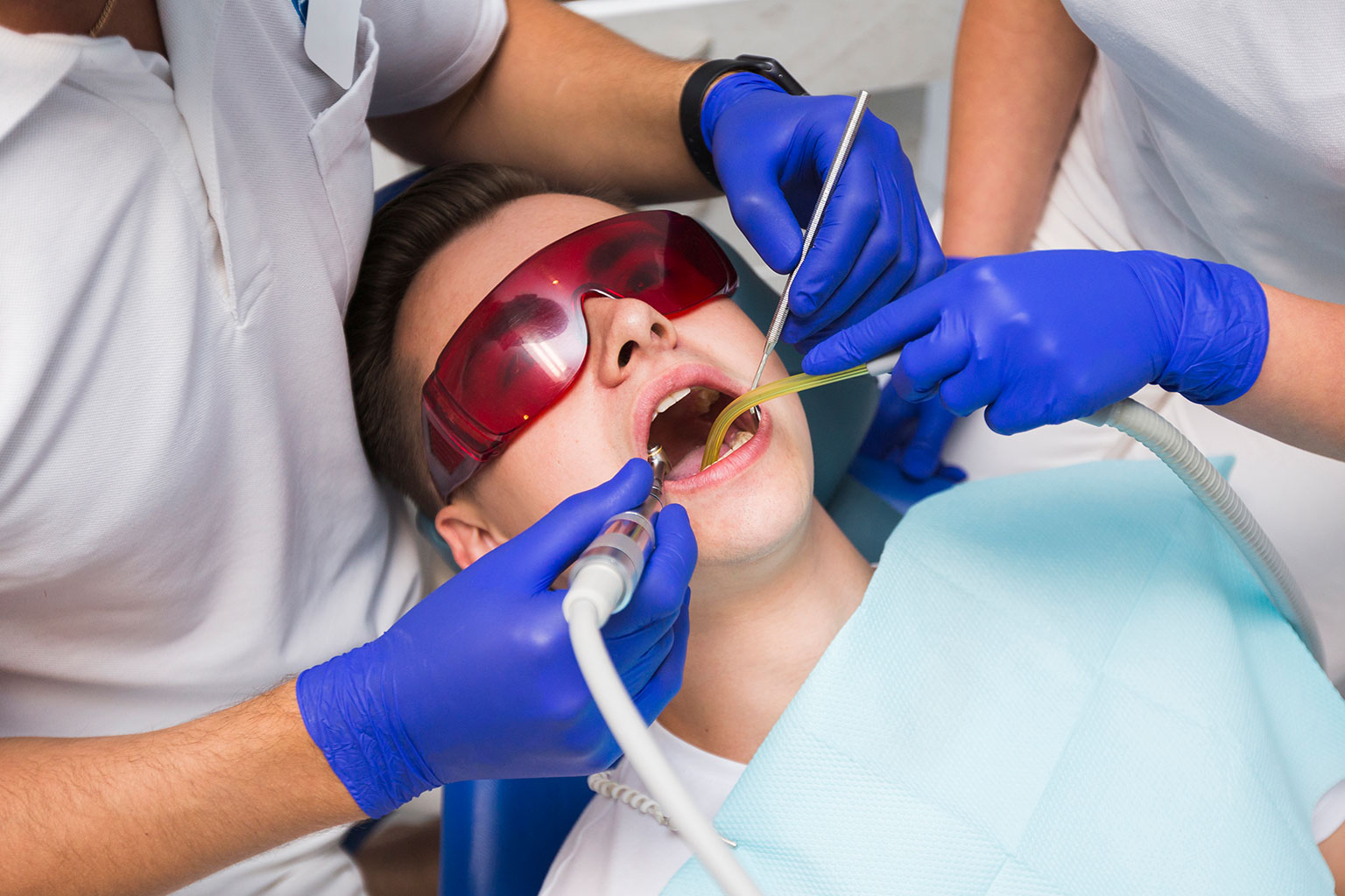 Tooth Extraction Procedure: Explained In A Nutshell