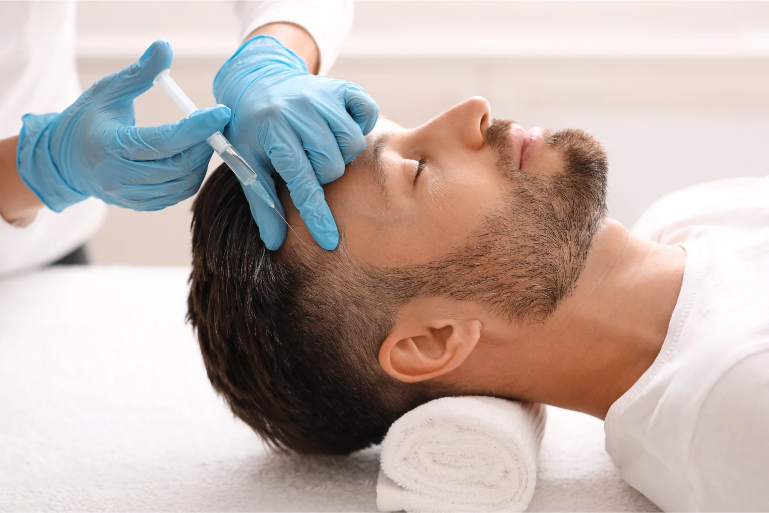 PRP therapy for hair loss on a man’s scalp.