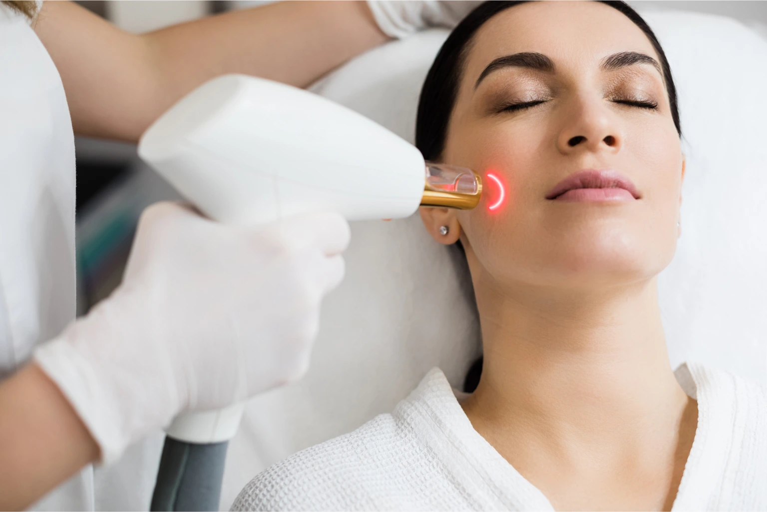 Woman Undergoing Facial Laser Hair Removal Treatment