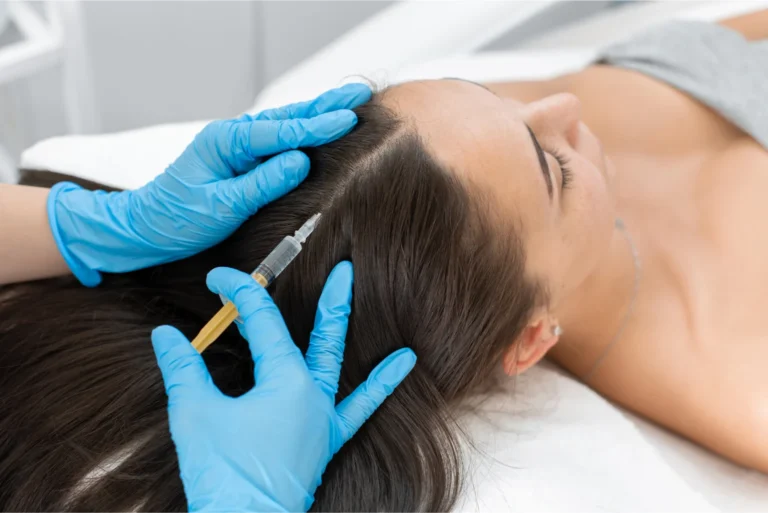 Understanding PRP Treatment For Hair Loss Recovery