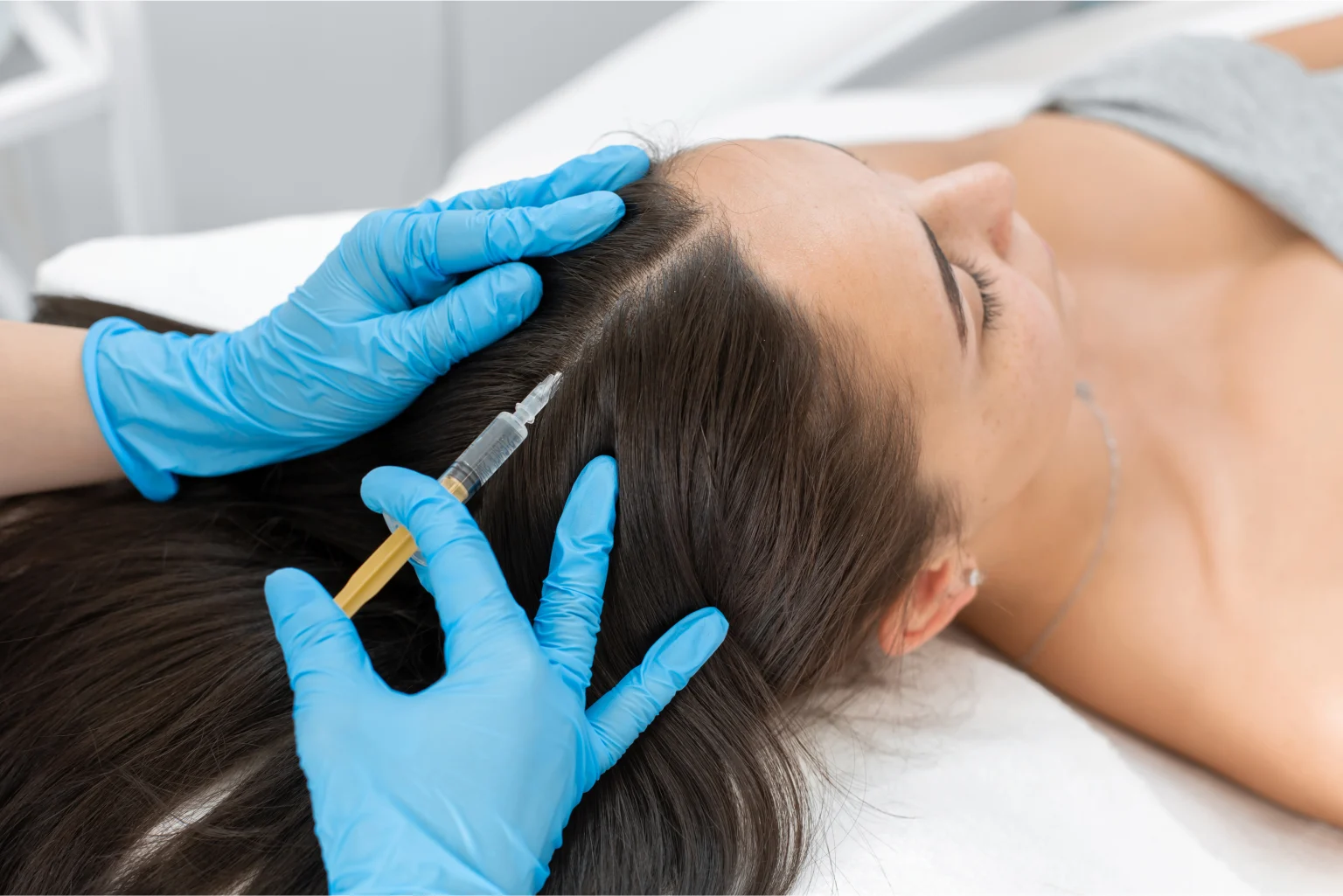 PRP hair treatment injection on a woman's scalp