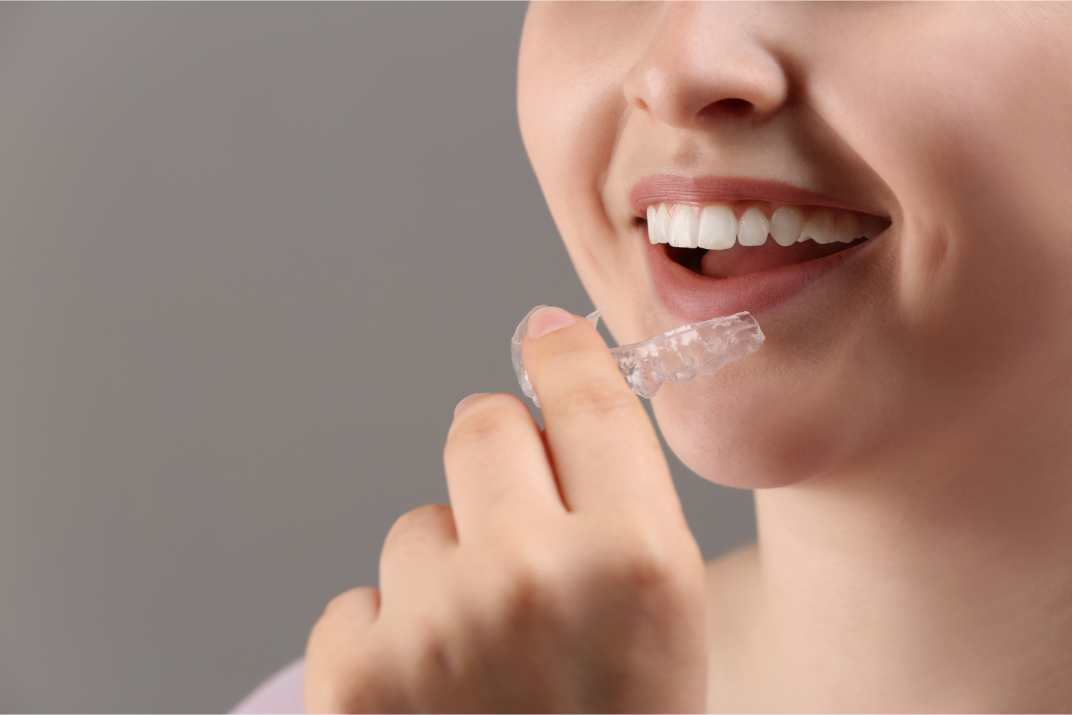 Woman placing clear aligner on teeth