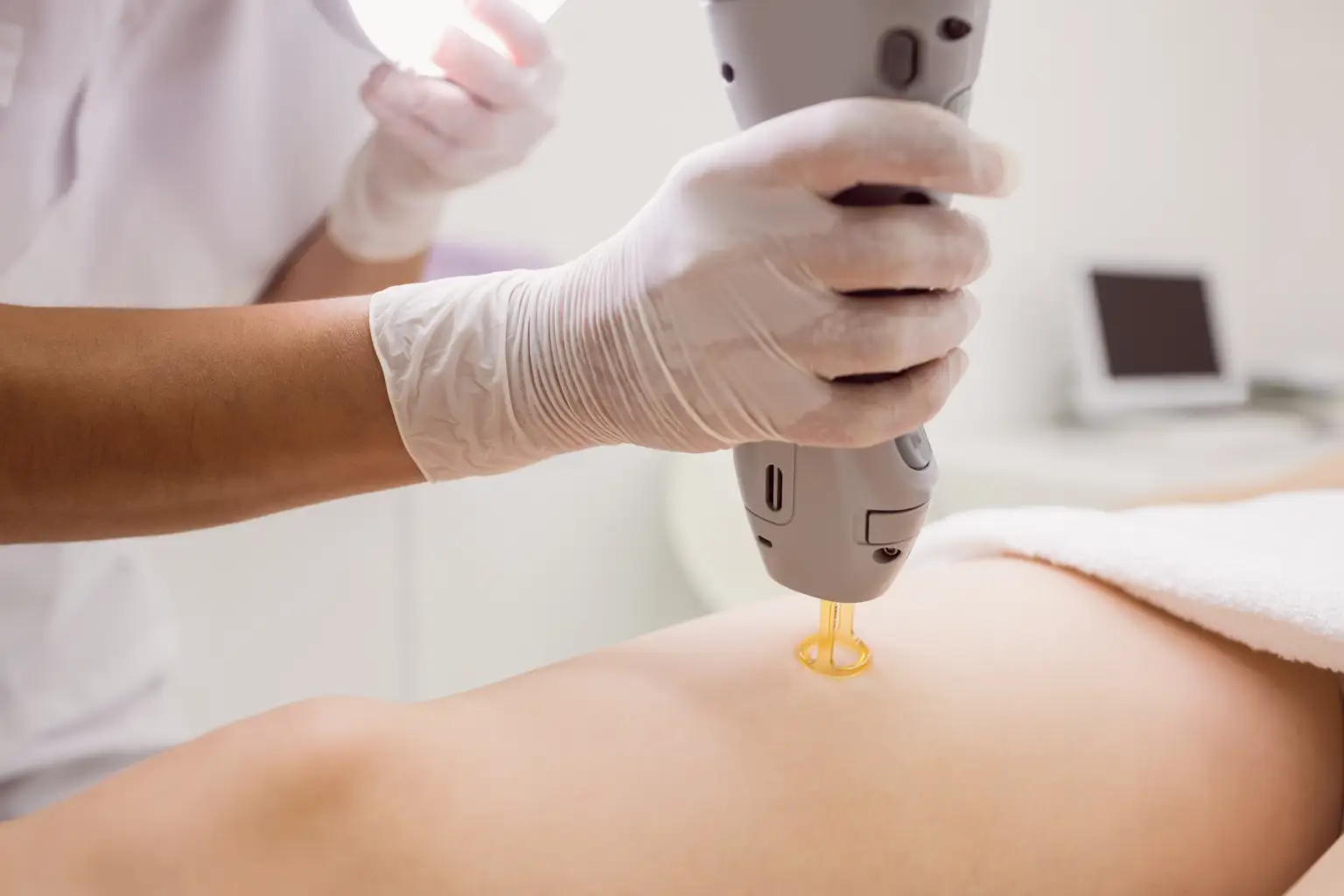 Woman undergoing laser hair removal treatment of leg