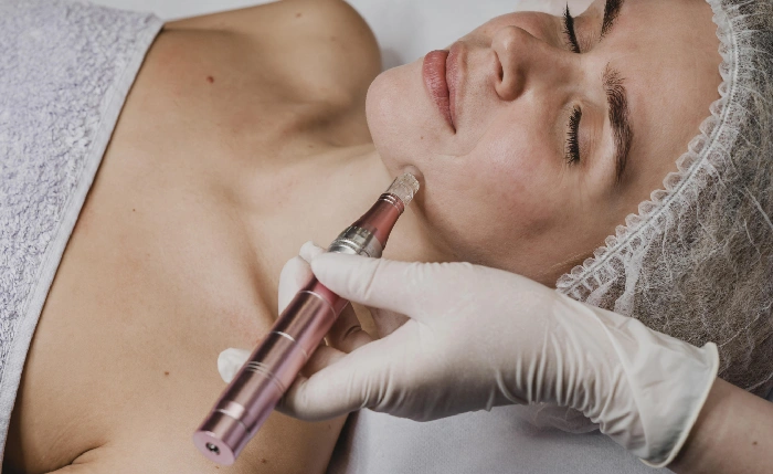 PRP therapy for skin rejuvenation and anti-aging benefits.