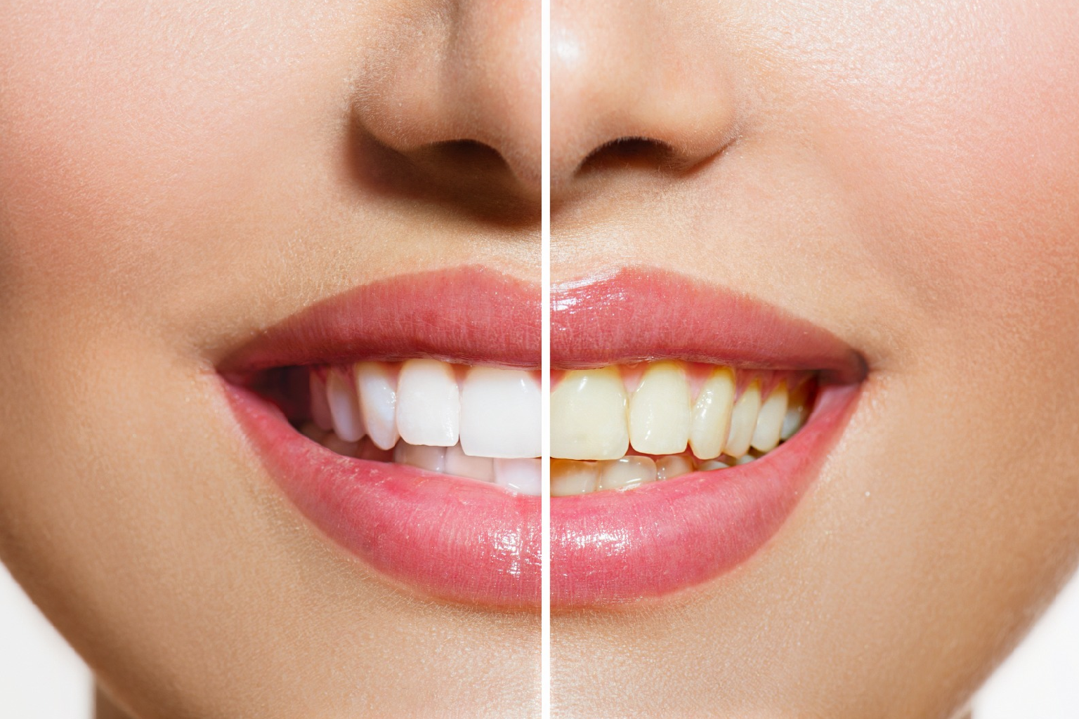 Woman showing off his bright smile after teeth whitening treatment