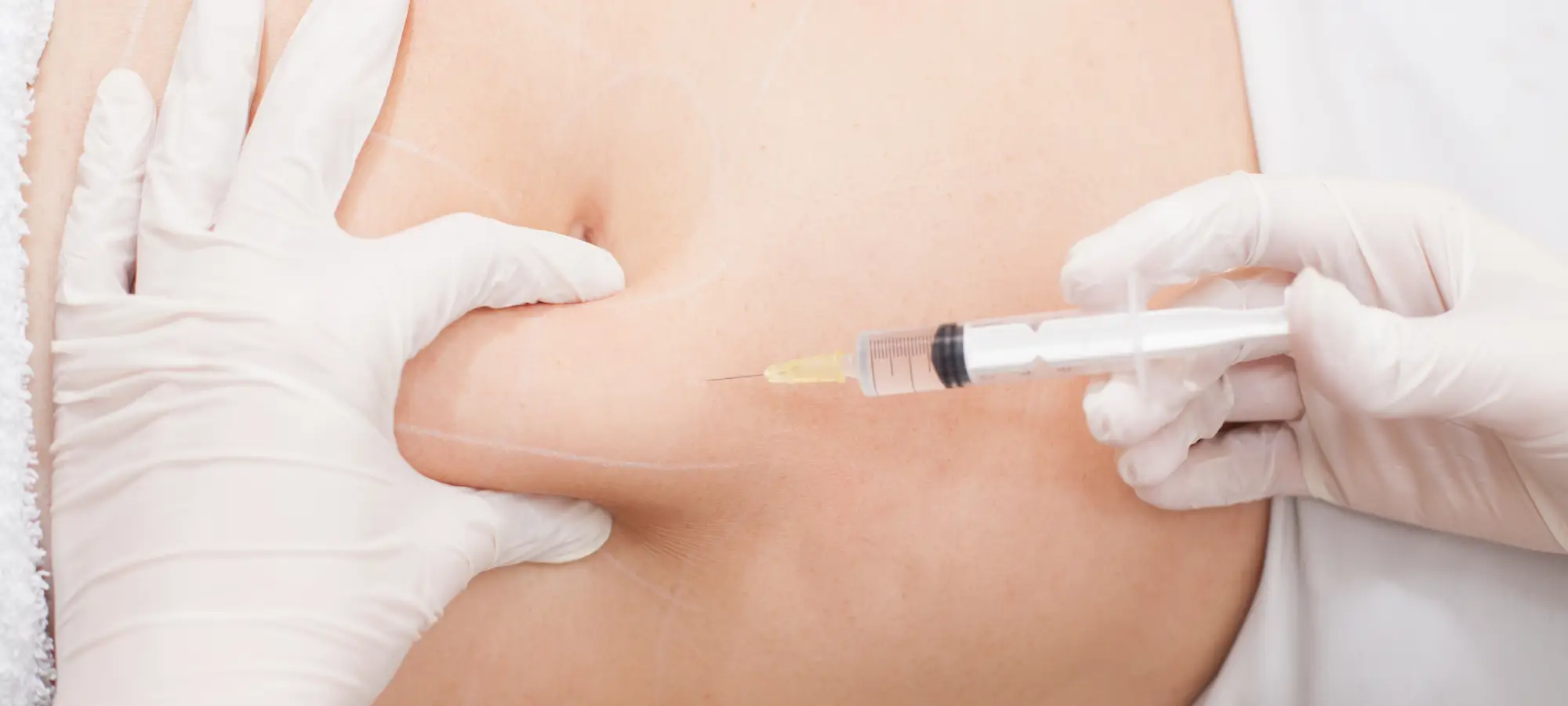 Mesolipo Treatment in Dubai | Non-Surgical Belly Fat Removal