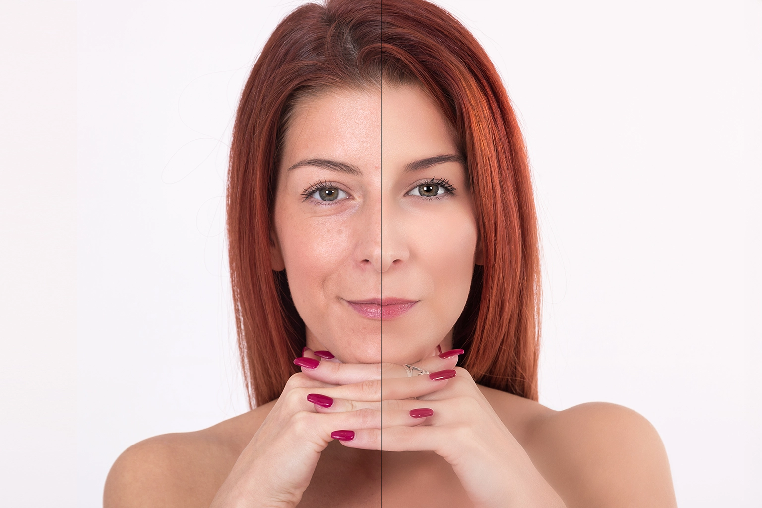 Before and after skincare effect on a red-haired woman’s face, showing improved skin clarity.