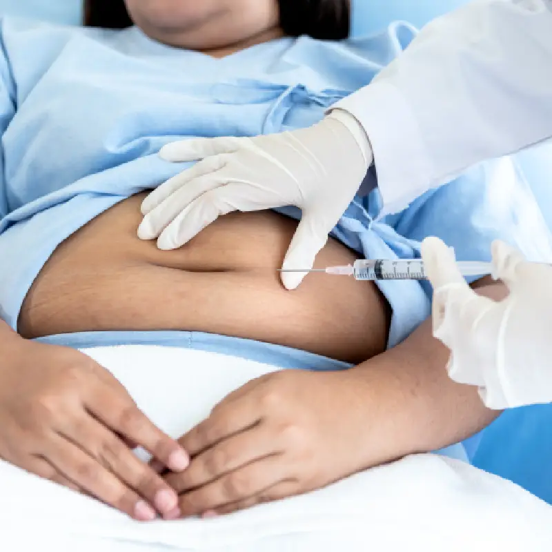Close-up of a medical professional performing a mesotherapy injection on the abdominal area