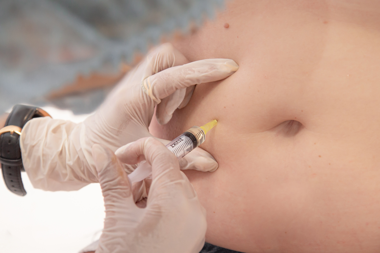 Person undergoing fat-dissolving injection treatment targeting side stomach fat