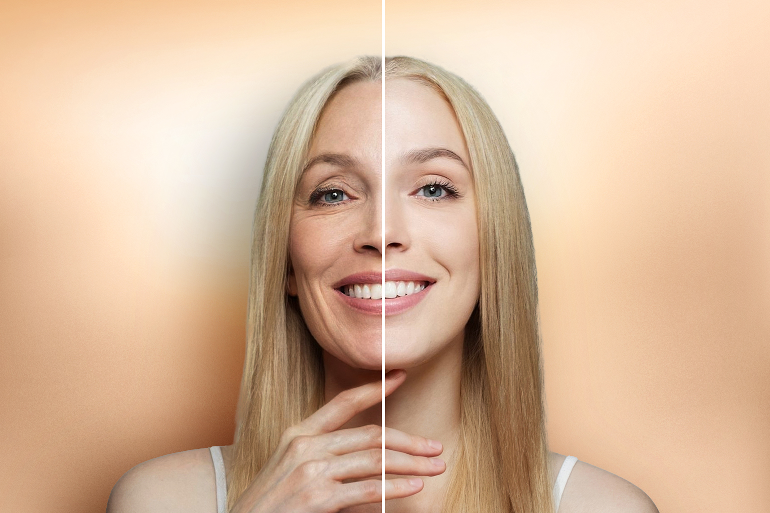 Before and after transformation of an aged woman after PRP facial treatment, showing improved skin texture and rejuvenation.