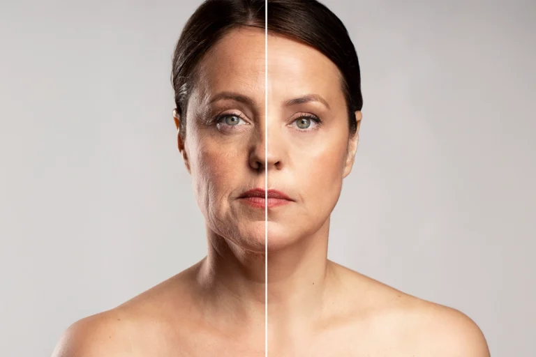 5 Key Reasons To Opt For PRP Facials To Achieve Anti-Aging Benefits