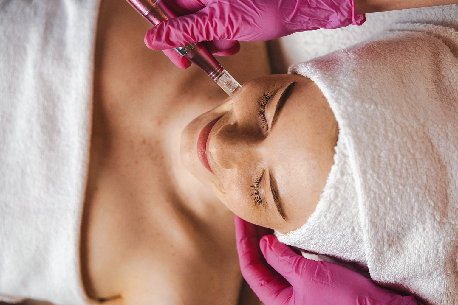 Woman receiving platelet-rich plasma treatment on her face for natural skin rejuvenation