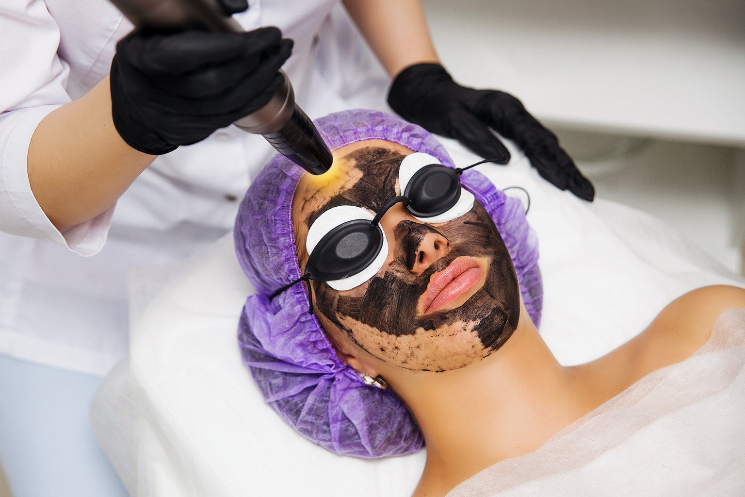 Woman receiving carbon laser peel treatment by a specialist using advanced laser equipment