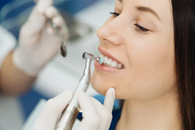 Dental Cleaning vs. Dental Polishing: What is Best For Oral Health?