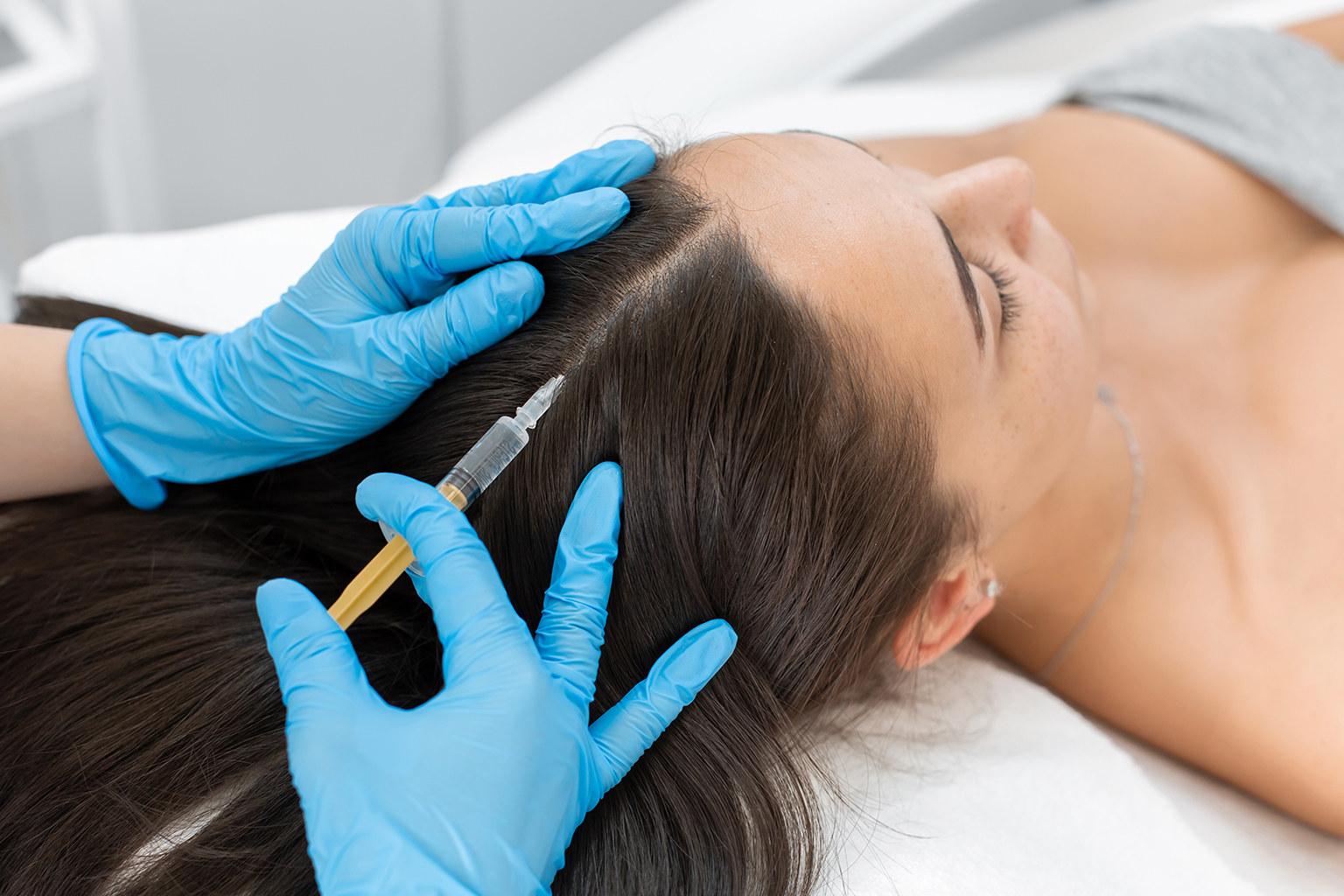 PRP hair treatment injected into the scalp