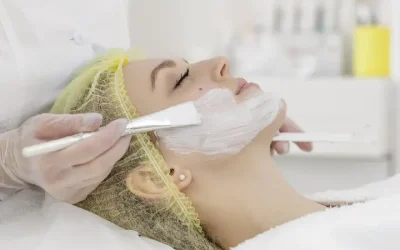 Chemical Peel